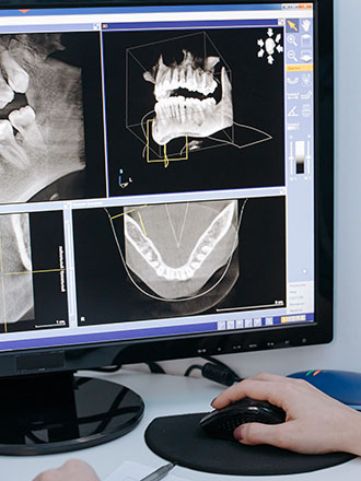 endodontic technology